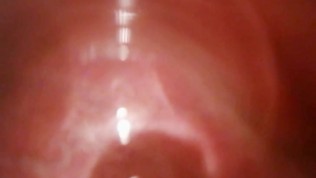 Extreme korean anal hairy sex